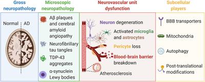 Peripheral Pathways to Neurovascular Unit Dysfunction, Cognitive Impairment, and Alzheimer’s Disease